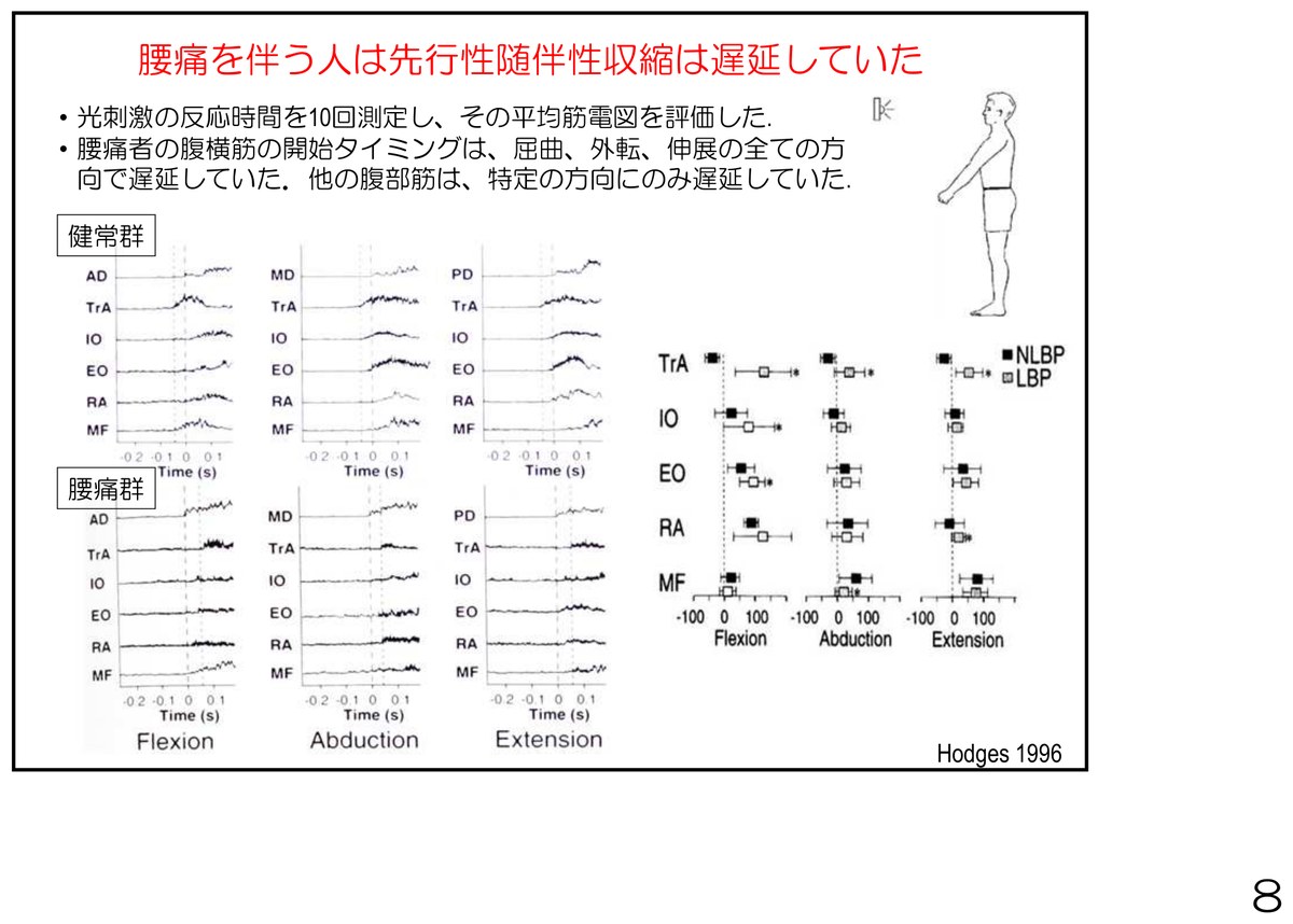 腰痛を伴う人は、腹横筋などの先行性随伴性収縮（先回りの収縮）の開始タイミングが、屈曲・外転・伸展の全方向で遅延していた（Hodges 1996）。