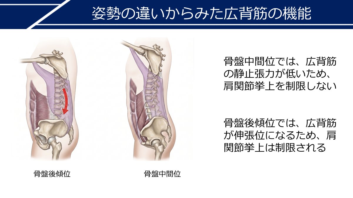 「姿勢の違いからみた広背筋の機能」と題したスライド。骨盤後傾位と骨盤中間位を左右に並べ、広背筋を紫で示した側面図で比較し、骨盤中間位では広背筋の静止張力が低いため肩関節挙上を制限しないこと、骨盤後傾位では広背筋が伸張位になるため肩関節挙上は制限されることを解説している