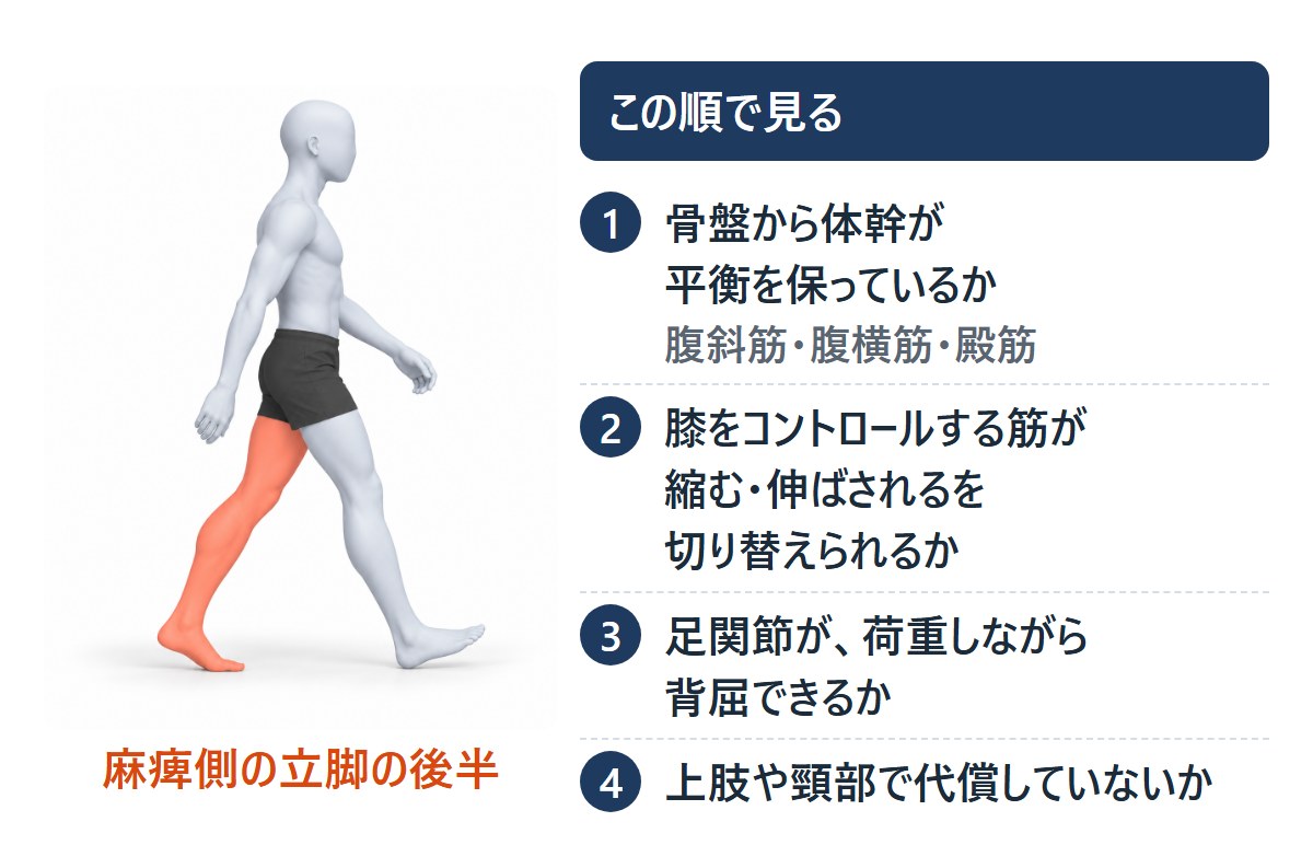 麻痺側の立脚後期の人の絵と、見る順番4つ。骨盤から体幹の平衡、膝の筋の切り換え、荷重しながらの背屈、上肢や頸部の代償