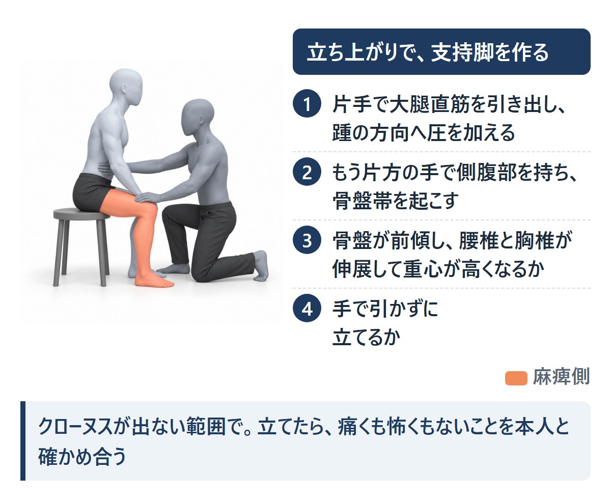 立ち上がりを誘導する二人の絵。片手で大腿直筋を引き出しながら踵の方向へ圧を加え、もう片方の手で側腹部を持って骨盤帯を起こす。骨盤の前傾と、手で引かずに立てるかを見る