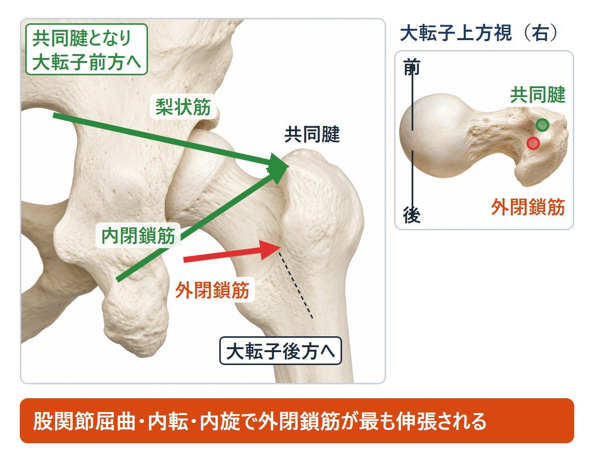 脱臼抵抗性に関与する深層外旋筋