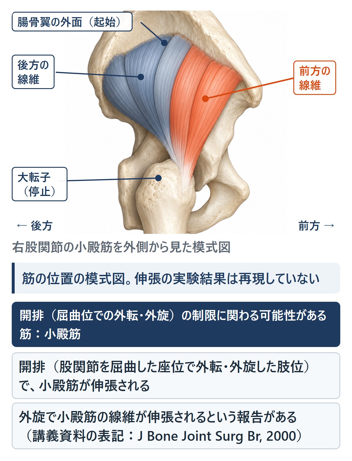 開排(屈曲位での外転・外旋)の制限に関わる可能性がある筋:小殿筋