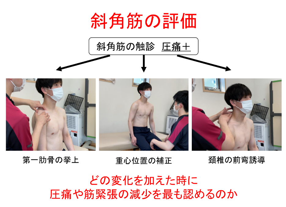 基礎から実践まで！胸郭出口症候群に対する評価と運動療法2