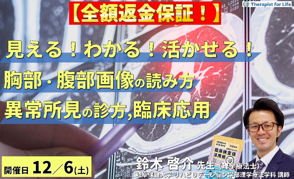  PT・OT・STのための「見える！わかる！活かせる！胸部・腹部画像の読み方」 ～異常所見の診方とリハビリへの応用～