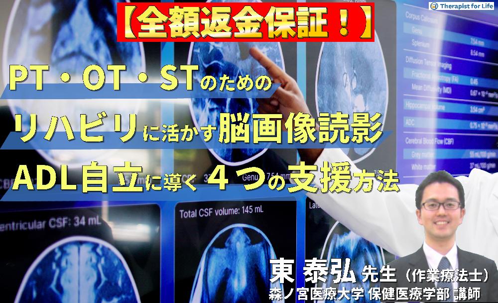 【見逃し配信】PT・OT・STのためのリハビリに活かす脳画像読影～「どこができなくて何が原因か」を読み解き、ADL自立へ導く４つの支援方法～