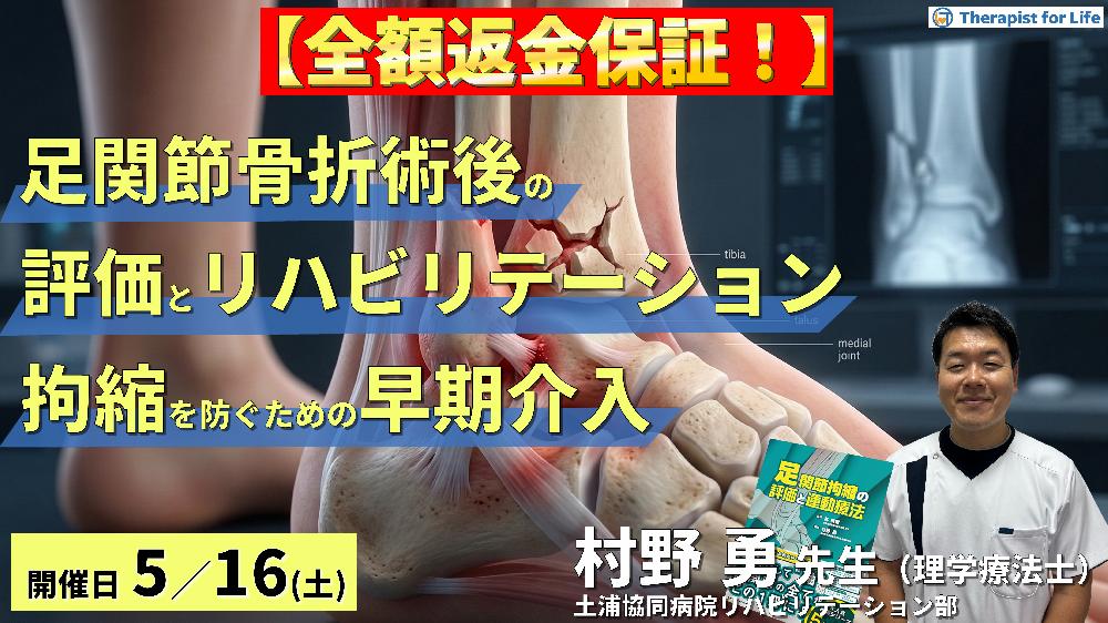 足関節骨折術後の評価とリハビリテーション～拘縮を防ぐための早期介入と運動療法～