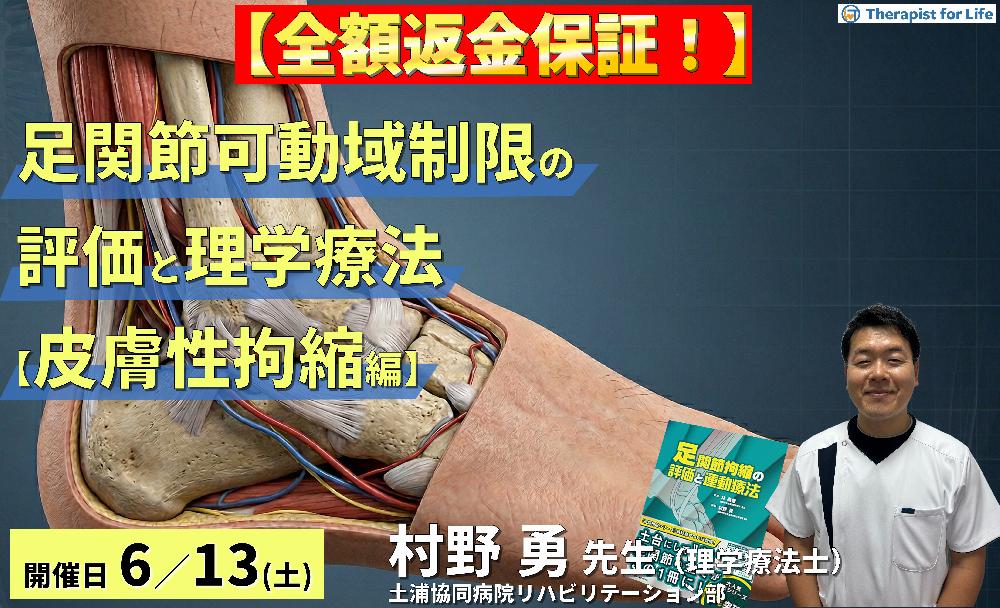 早割中！【皮膚性拘縮編】足関節可動域制限の評価と運動療法～皮膚性・筋性拘縮の鑑別とエコー・触診による臨床介入～