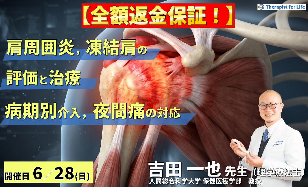 【早割中！】肩関節周囲炎・凍結肩の評価と治療〜病期で変わるアプローチと夜間痛への対応〜